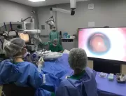 Tecnologia 3D chega às cirurgias oftalmológicas fe