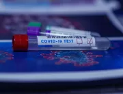 Uberlândia ultrapassa 11 mil casos de coronavírus
