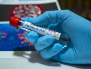 Mais 19 casos de coronavírus são confirmados em Ub