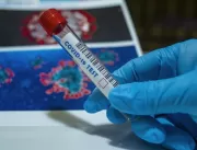 SMS confirma 178 casos de coronavírus nas últimas 