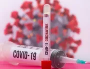 Boletim não registra novos óbitos pelo coronavírus