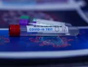 Boletim aponta 422 novos casos de coronavírus em U