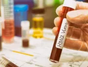 Prefeitura confirma caso de H3N2 em Uberlândia