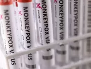 Uberlândia tem cinco casos suspeitos de varíola do