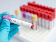 Mundo tem 2,5 milhões de novos casos de HIV por an