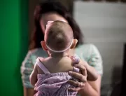 Zika pode afetar ‘dezenas de milhares’ de bebês na