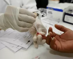 Casos de sífilis sobem quase 34% em Uberlândia 