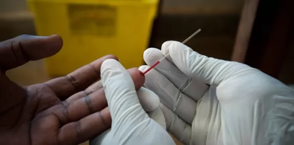Diagnóstico de pessoas com HIV cresce 18%
