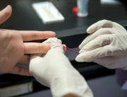 Ambulatório oferece teste de HIV na UFU