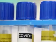 Boletim aponta mais um caso de coronavírus confirm