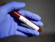 Uberlândia tem 24 casos confirmados de coronavírus