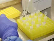 Uberlândia registra 150 casos do novo coronavírus