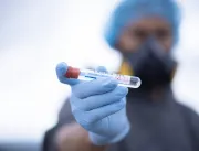 Uberlândia chega a 12.453 pacientes infectados pel
