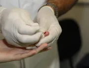 ​Testes rápidos para HIV podem ser feitos por agen