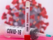 176 novos casos da Covid-19 são registrados em Ube