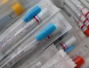 Boletim aponta 6 mortes por coronavírus em Uberlân