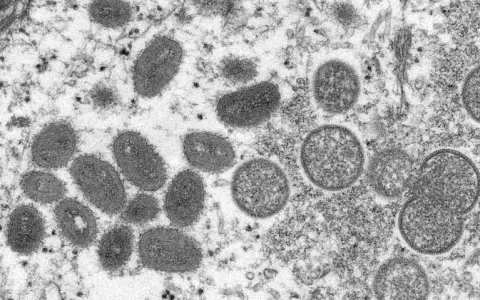 Sobe para 142 o número de casos de varíola dos mac