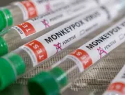 Primeira morte por varíola dos macacos no Brasil é