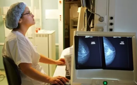 Mamografias periódicas evitam mortes por câncer de
