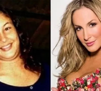 Veja o antes e depois dos famosos