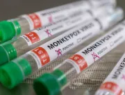 Rio de Janeiro confirma quinto caso de varíola dos