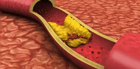 Taxa de colesterol no sangue: o controle pode salv