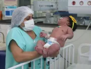 SANTA CASA Bebê que nasceu em Belém pode ser um dos maiores no mundo 