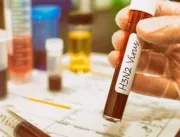 Sespa confirma 41 casos de  H3N2 em Belém 