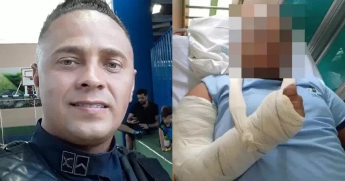 Policial Militar quebra braço de adolescente autista durante crise - Jornal  Pará