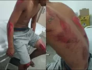 Vídeo mostra jovem sofrendo queda de moto durante 