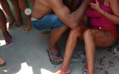 Mulher leva facada no rosto no Junco, município de