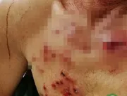 Homem atira no próprio irmão durante briga de famí