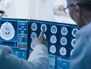 Nova técnica permite diagnosticar Alzheimer com ma