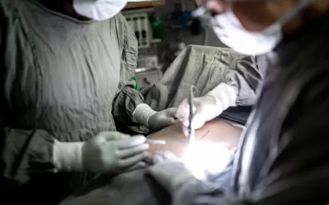 Lipoaspiração: O que esperar desta cirurgia no hom