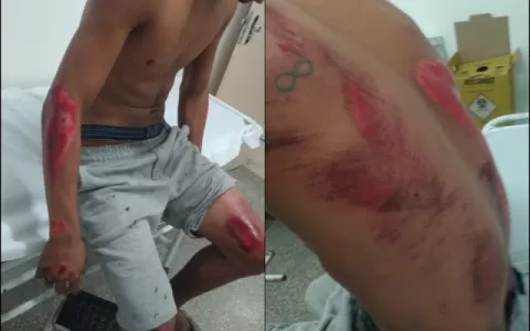 Vídeo mostra jovem sofrendo queda de moto durante 
