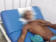 Jovem sofre traumatismo após briga no povoado de M