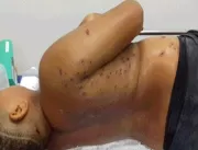 Adolescente de 12 anos que sofreu tentativa de hom
