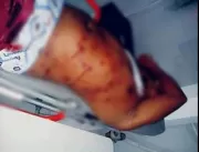 Homem é atingido com tiro de bate-bucha no municíp