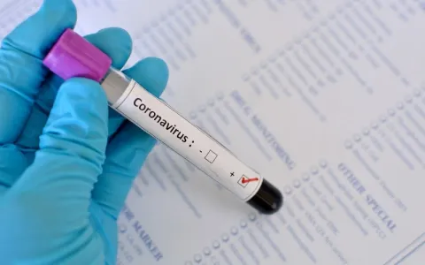 Serrolândia registra mais 4 casos positivos de COV