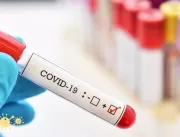 Serrolândia registra 6 casos de Covid-19 nesta qui