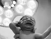 Foto de bebê tirando máscara de médico após o part