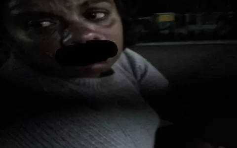 [VÍDEO] Homem arranca parte do lábio de ex-mulher 