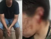 Marido morde e arranca pedaço de orelha da esposa 