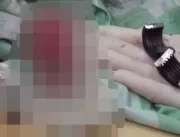 VÍDEO: Homem é hospitalizado após sua esposa prend
