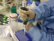 Anvisa aprova oito testes rápidos para coronavírus