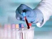 Paraíba triplica oferta de exame laboratorial para