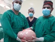IMPRESSIONANTE: Tumor de quase 20 kg é retirado do