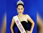Miss de 17 anos morre após sofrer mal súbito; polí