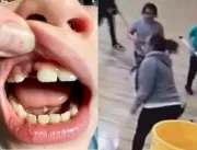 CHOCANTE: Vídeo flagra professora quebrando dente 