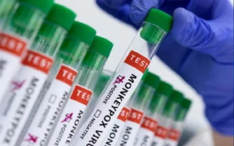RJ confirma primeira morte por varíola dos macacos
